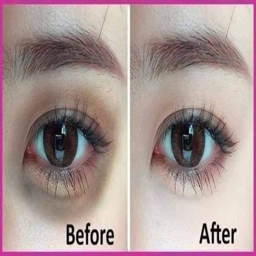 Pannamas Eye Gel Dark Circles Under Eye Treatment